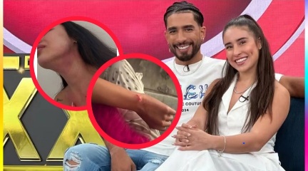 Renzo Meneses y Ana María Restrepo: video viral por presunta agresión desata polémica en redes